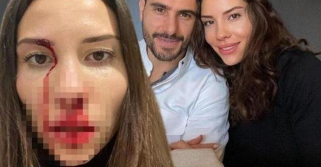 Özer Hurmacı ile eşinin darp davasında karar çıktı! İşte verilen ceza! - Foto Haber 9