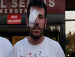 Gözünde çiviyle 7 hastane dolaştı