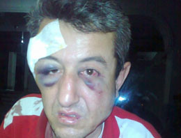 Polisten pompacıya darp