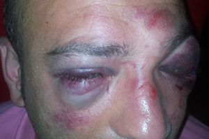 Trabzon'da polis bebeğe biber gazı sıktı