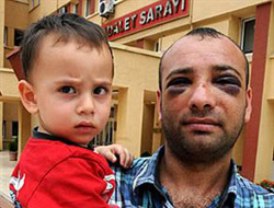 Trabzon'da o polis görevden alındı