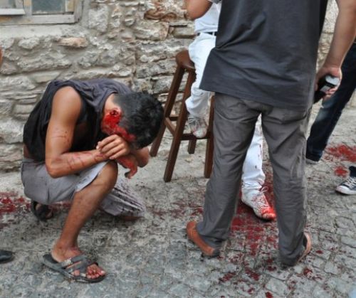 'Neden yan baktın?' kavgası