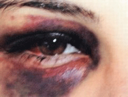 İşte bu da şiddetin fotoğrafı !