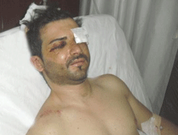 Genç Oyuncuyu Hastanelik Ettiler