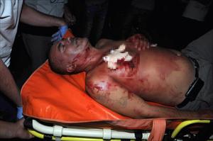 Sigara istediler sonra...