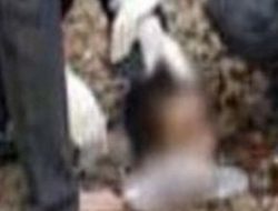 Yanlışlıkla kafasını kesti