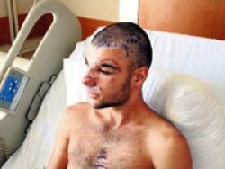 Botun pervanesi yüzünü parçaladı