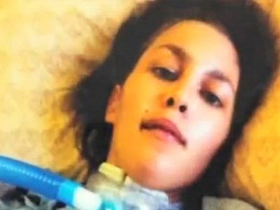 Kafası Koptu ama Ölmedi