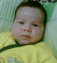 İki yaşında beyninde tümer'e yenildi!