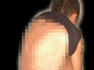 20 yıldır hastalığına teşhis konulamıyor