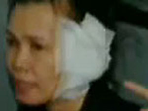 İş arkadaşının kulağını ısırıp koparttı