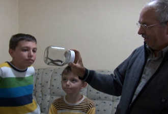 Vücudunun her iki tarafında kafası var