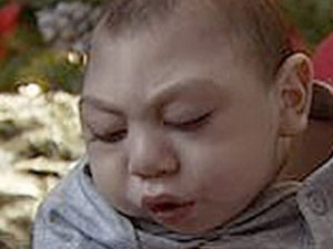 Beyni olmadan 3 yıl yaşadı