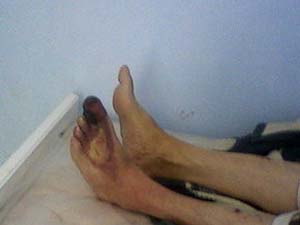 Yaşlı ve engellilere kötü muamele....