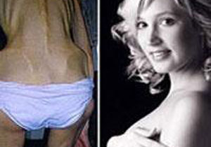 'Zombi' kız şimdi güzel bir anne