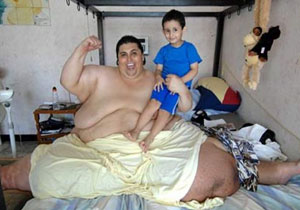 Vücudunun yarısını verdi