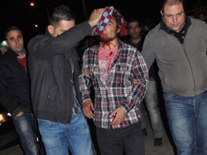 Ölümden döndüler