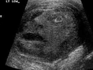 İnsan Yüzlü Ur Görenleri Şoke Etti