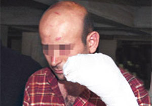 Pitbull, hırsızı parçalıyordu!