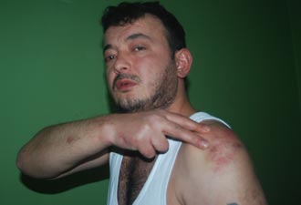 Giresun'da polisten orantısız güç !