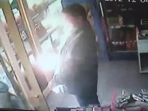 Yüzü ve saçı yanan Rize'li adam şoka girdi