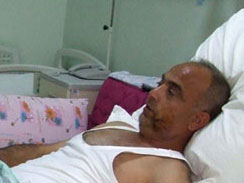 Yağmurdan kaçarken ayıya yakalandılar