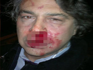 Ünlü modacıyı feci dövdüler