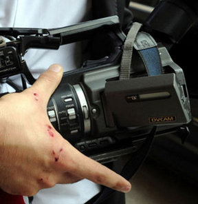 Gazeteciler sakın yıpranmayın!