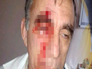 Reçete yazmayan doktora saldırı