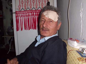 Trabzon'da ilginç yaralanma !