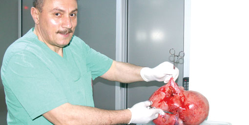 Karnından 8 kg kitle çıktı