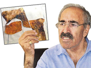 Doktorların ağzı açık kaldı!