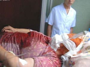 Eşinin yüzünü testereyle kesti