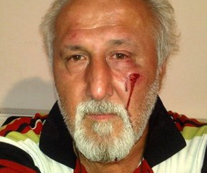 AK Partili başkandan gazeteciye yumruk!