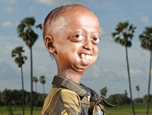 110 yaşında gibi görünen çocuk!