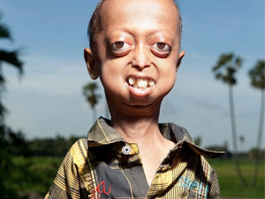 Kendisi 14 vücudu 110 yaşında!