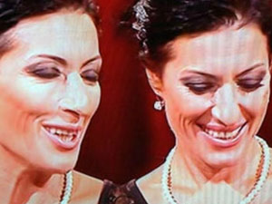 Ünlü türkücü tanınmaz halde!