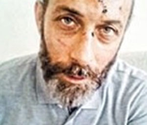 Ünlü müzisyene silahlı saldırı