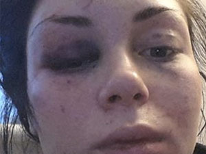 Saldırıp fotoğraflarını Facebook’tan yolladılar !