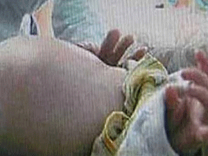 Bebeğin içinden bebek çıktı!