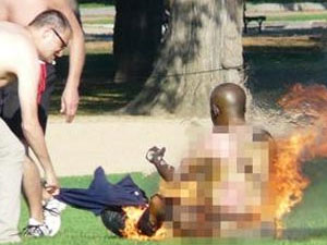 Herkesin gözü önünde kendini yaktı