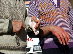 Acemi kasaplara özel sağlık paketi