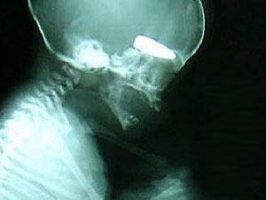 Dehşete düşüren iddia!