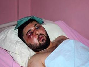 Trabzon'da ifadesi alınan darpçılar serbest kaldı