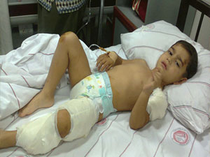 Köpek çocuğa saldırdı...!