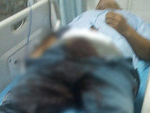 Depresyona girdi ve penisini doğradı!