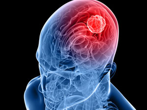 5 yıl sonrasına dikkat!