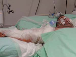 Otomatik kapı kolunu kopardı !