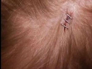 Başına göktaşı düştü!