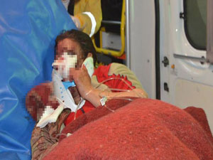 Öğretmene feci dayak